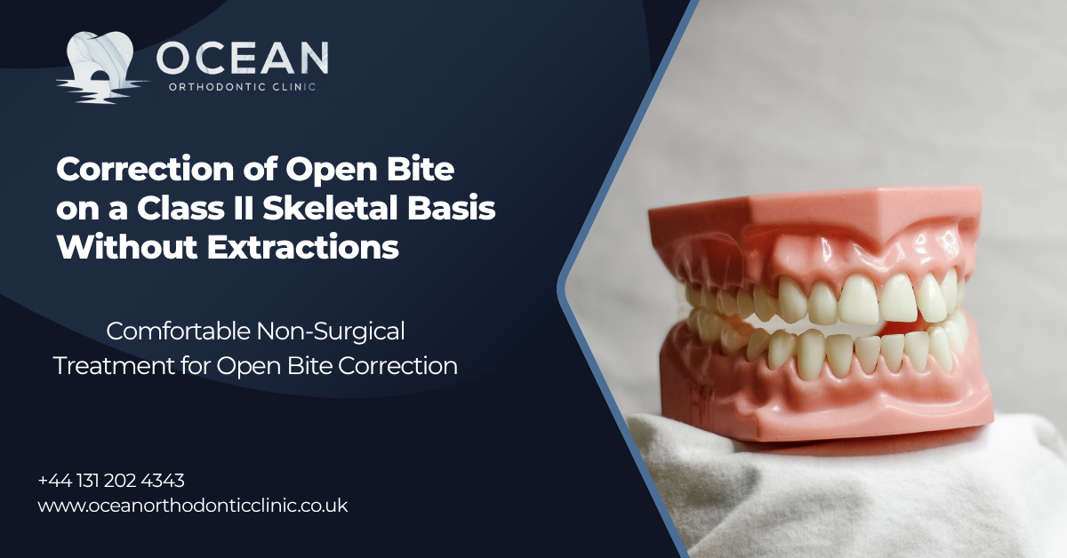 Open Bite & Class II Correction Without Surgery